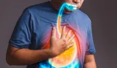 ਐਸਿਡਿਟੀ ਅਤੇ ਤੇਜ਼ਾਬ ਤੋਂ ਪਰੇਸ਼ਾਨ ਹੋ? ਜਾਣੋ ਕਿਹੜੇ ਖਾਣਿਆਂ ਤੋਂ ਪਰਹੇਜ਼ ਕਰਨਾ ਹੈ ਜ਼ਰੂਰੀ