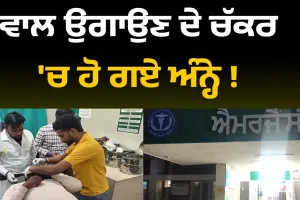 ਗੰਜੇਪਨ ਤੋਂ ਛੁਟਕਾਰਾ ਪਾਉਣ ਦੇ ਚੱਕਰ 'ਚ ਲੋਕ ਹੋ ਗਏ ਅੰਨ੍ਹੇ ! 