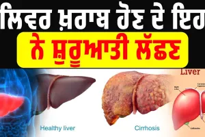 ਲਿਵਰ ਖ਼ਰਾਬ ਹੋਣ ਦੇ ਇਹ ਨੇ ਸ਼ੁਰੂਆਤੀ ਲੱਛਣ ,ਵੱਡੀ ਬਿਮਾਰੀ ਤੋਂ ਬਚਾਅ ਲਈ ਐਵੇਂ ਕਰੋ ਇਲਾਜ਼