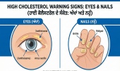  ਅੱਖਾਂ 'ਤੇ ਨਹੁੰਆਂ 'ਚ ਦਿਖਣ ਇਹ ਬਦਲਾਅ ਤਾਂ ਹੋ ਜਾਓ ਸਾਵਧਾਨ;ਇਹ ਨੇ ਹਾਈ ਕੋਲੈਸਟਰੋਲ ਦੇ 5 ਖਤਰਨਾਕ ਸੰਕੇਤ
