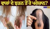 ਵਾਲਾਂ ਦੇ ਝੜਨ ਤੋਂ ਹੋ ਪਰੇਸ਼ਾਨ? ਅਪਣਾਓ ਇਹ 5 ਕੁਦਰਤੀ ਤਰੀਕੇ, ਵਾਲ ਹੋਣਗੇ ਲੰਬੇ, ਕਾਲੇ ਅਤੇ ਘਣੇ