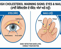  ਅੱਖਾਂ 'ਤੇ ਨਹੁੰਆਂ 'ਚ ਦਿਖਣ ਇਹ ਬਦਲਾਅ ਤਾਂ ਹੋ ਜਾਓ ਸਾਵਧਾਨ;ਇਹ ਨੇ ਹਾਈ ਕੋਲੈਸਟਰੋਲ ਦੇ 5 ਖਤਰਨਾਕ ਸੰਕੇਤ