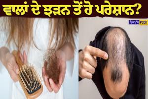 ਵਾਲਾਂ ਦੇ ਝੜਨ ਤੋਂ ਹੋ ਪਰੇਸ਼ਾਨ? ਅਪਣਾਓ ਇਹ 5 ਕੁਦਰਤੀ ਤਰੀਕੇ, ਵਾਲ ਹੋਣਗੇ ਲੰਬੇ, ਕਾਲੇ ਅਤੇ ਘਣੇ